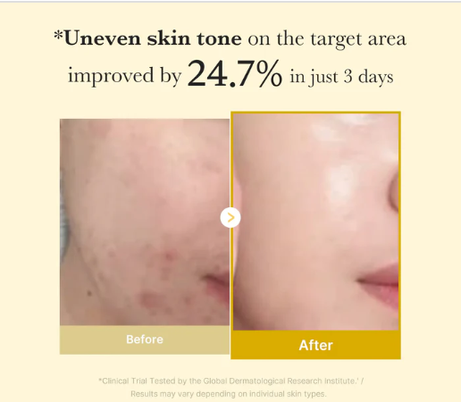 FADE DARK SPOTS WITH KOJIC ACID TURMERIC WRAPPING MASK