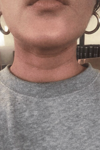 Before - Amy P.