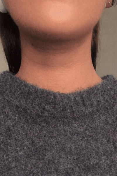 After - Amy P.